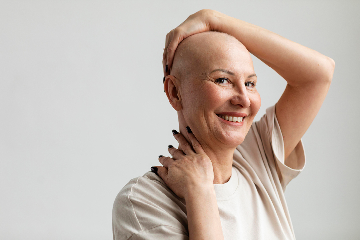 My First Bald Selfie: Navigating Hair Loss image
